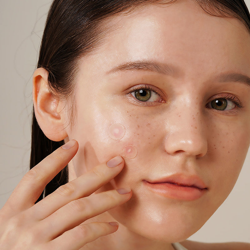 Isntree Onion Newpair Spot Patch Basic